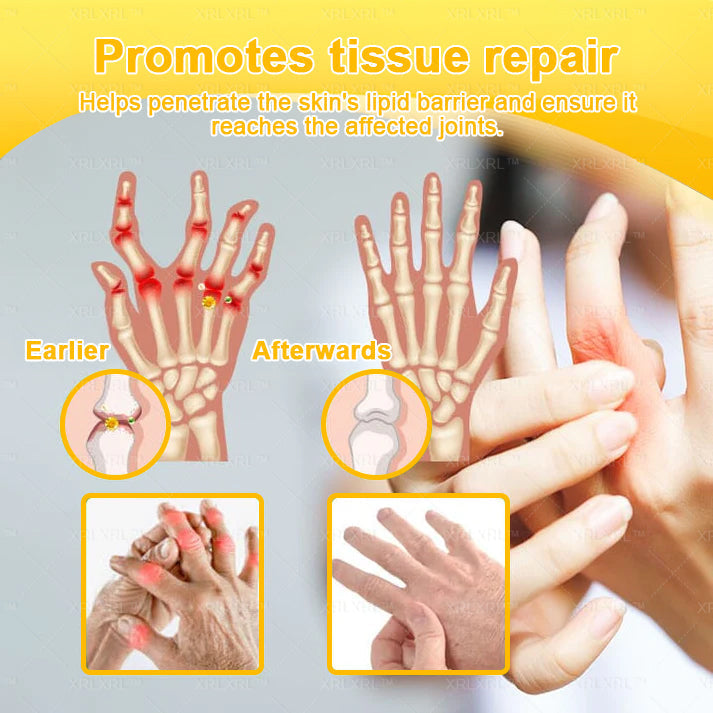 XRLXRL® Bee Venom Pain-Relief Bone Healing Cream 📦(Specially for older adults)