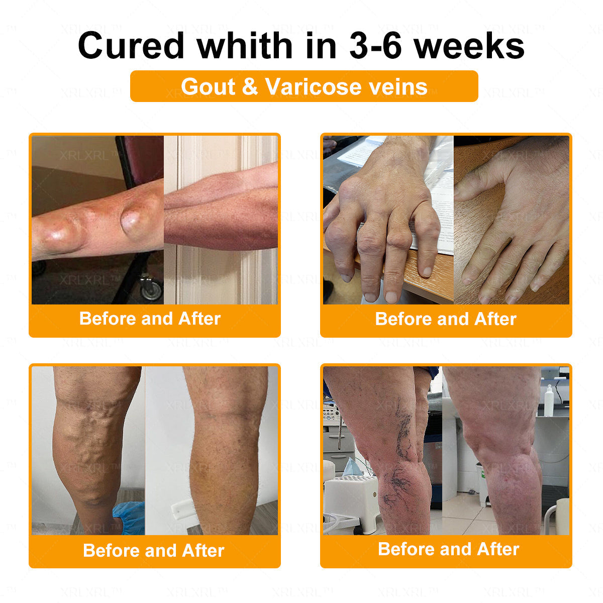 XRLXRL® Bee Venom Pain-Relief Bone Healing Cream 📦(Specially for older adults)