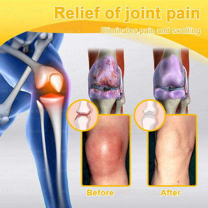 XRLXRL® Bee Venom Pain-Relief Bone Healing Cream 📦(Specially for older adults)